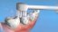 WaterPik Toothbrush trysky TB100, 2ks