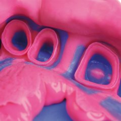 Zhermack Hydrorise Light Body A-silikónový odtlačkový materiál, 2x50ml