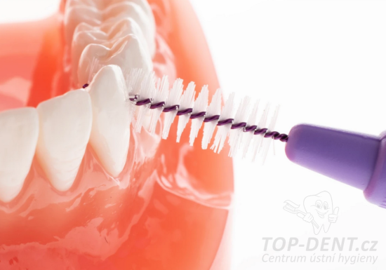 TePe ORIGINAL 6 medzizubné kefky 1,1 mm, 25ks