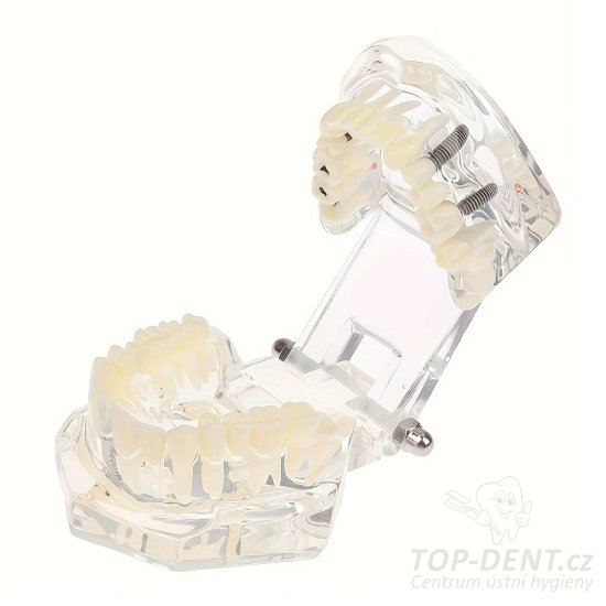 Model lidskeho chrupu anatomický, 1 ks