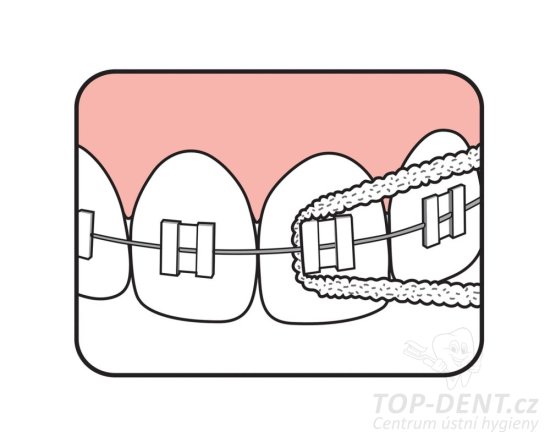 TePe Bridge & Implant Floss zubní nit, 30ks