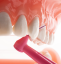 TePe ANGLE 0 mezizubní kartáčky 0,4 mm, 25ks