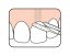 TePe Bridge & Implant Floss zubní nit, 30ks