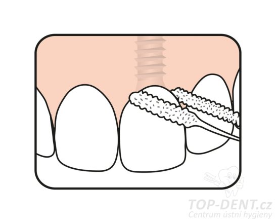 TePe Bridge & Implant Floss zubní nit, 30ks