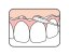 TePe Bridge & Implant Floss zubní nit, 30ks